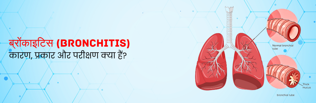 ब्रोंकाइटिस: इसके कारण, प्रकार और निदान के लिए परीक्षण क्या हैं?